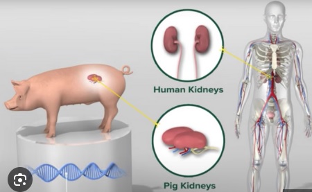 porcine kidneys for transplant
